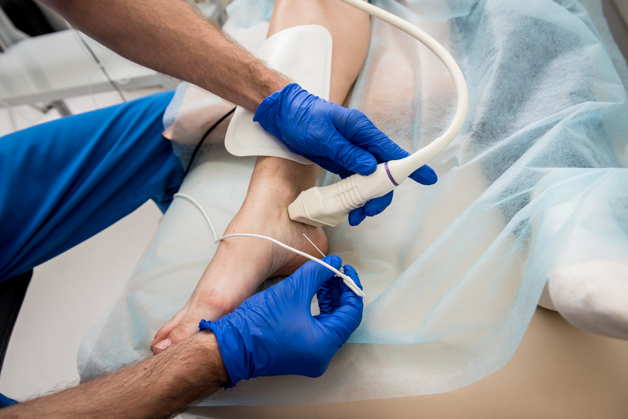 Radiofrequency Lesioning: Things to Know - The Spine Diagnostic & Pain