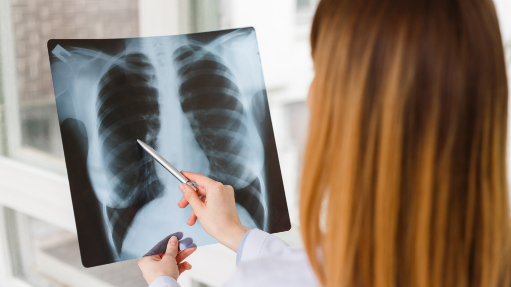 What is Radiofrequency Lesioning? The Spine Diagnostic Center